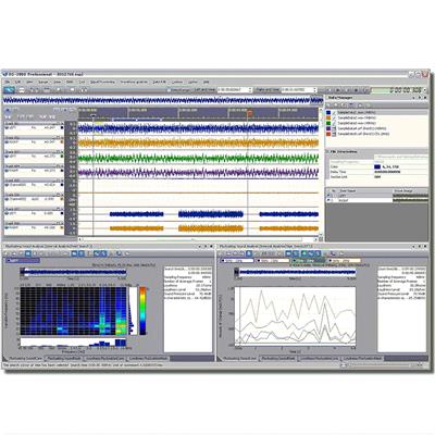 日本小野 抖动音评价分析软件 OS-2760